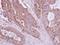 Huntingtin Interacting Protein 1 Related antibody, LS-C155473, Lifespan Biosciences, Immunohistochemistry paraffin image 