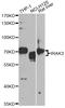 Interleukin 1 Receptor Associated Kinase 3 antibody, A5467, ABclonal Technology, Western Blot image 