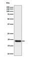 Tumor necrosis factor alpha-induced protein 8 antibody, M05158-1, Boster Biological Technology, Western Blot image 