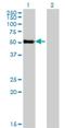 Zinc Finger Protein 232 antibody, H00007775-M06, Novus Biologicals, Western Blot image 