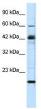 Zinc Finger Protein 24 antibody, TA333902, Origene, Western Blot image 