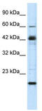 Zinc Finger Protein 24 antibody, TA333902, Origene, Western Blot image 