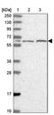 Beta,beta-carotene 9 ,10 -oxygenase antibody, NBP1-90770, Novus Biologicals, Western Blot image 