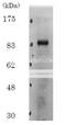 Denticleless E3 Ubiquitin Protein Ligase Homolog antibody, 70-115, BioAcademia Inc, Western Blot image 