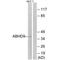 Epoxide Hydrolase 3 antibody, A17170, Boster Biological Technology, Western Blot image 