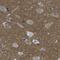 WNK Lysine Deficient Protein Kinase 2 antibody, PA5-53440, Invitrogen Antibodies, Immunohistochemistry paraffin image 