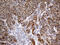 Cytochrome C Oxidase Copper Chaperone COX17 antibody, M04584, Boster Biological Technology, Immunohistochemistry paraffin image 