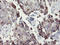 Snail Family Transcriptional Repressor 2 antibody, LS-C175194, Lifespan Biosciences, Immunohistochemistry paraffin image 