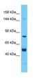 Complement C8 Gamma Chain antibody, orb324966, Biorbyt, Western Blot image 