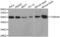 Tubulin Alpha 4a antibody, abx002287, Abbexa, Western Blot image 