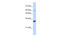 Leucine Rich Repeat Containing 57 antibody, 27-050, ProSci, Western Blot image 