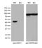 Farnesyl-Diphosphate Farnesyltransferase 1 antibody, M05118-2, Boster Biological Technology, Western Blot image 