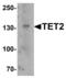 Tet Methylcytosine Dioxygenase 2 antibody, LS-C153760, Lifespan Biosciences, Western Blot image 