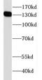 Family With Sequence Similarity 111 Member B antibody, FNab02954, FineTest, Western Blot image 