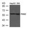 Pyruvate Kinase M1/2 antibody, TA347826, Origene, Western Blot image 