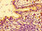 Cellular Communication Network Factor 2 antibody, LS-C285691, Lifespan Biosciences, Immunohistochemistry paraffin image 