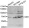 Dopamine Beta-Hydroxylase antibody, abx002064, Abbexa, Western Blot image 