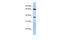 Ubiquitin Specific Peptidase 3 antibody, 25-151, ProSci, Western Blot image 