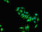 Suppressor Of Cytokine Signaling 2 antibody, orb53015, Biorbyt, Immunofluorescence image 