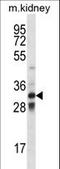 T Cell Leukemia Homeobox 1 antibody, LS-B10677, Lifespan Biosciences, Western Blot image 