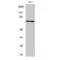 LIMK antibody, LS-C381183, Lifespan Biosciences, Western Blot image 