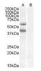 Diacylglycerol O-Acyltransferase 2 antibody, orb19428, Biorbyt, Western Blot image 