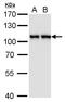 Chromosome Segregation 1 Like antibody, MA5-18301, Invitrogen Antibodies, Western Blot image 