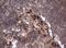 Phosphatidylinositol-4,5-bisphosphate 3-kinase catalytic subunit alpha isoform antibody, NBP2-46403, Novus Biologicals, Immunohistochemistry frozen image 
