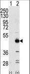 Tribbles Pseudokinase 3 antibody, LS-C100924, Lifespan Biosciences, Western Blot image 