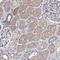 TRPM8 Channel Associated Factor 2 antibody, NBP1-91881, Novus Biologicals, Immunohistochemistry paraffin image 