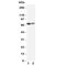 ATP Binding Cassette Subfamily D Member 3 antibody, R31203, NSJ Bioreagents, Western Blot image 