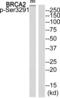 BRCA2 DNA Repair Associated antibody, abx012742, Abbexa, Western Blot image 