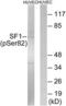 Splicing Factor 1 antibody, LS-C199561, Lifespan Biosciences, Western Blot image 