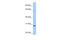 Hypoxanthine Phosphoribosyltransferase 1 antibody, 26-316, ProSci, Enzyme Linked Immunosorbent Assay image 