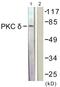 Protein Kinase C Delta antibody, LS-B7634, Lifespan Biosciences, Western Blot image 