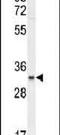 Chromosome 11 Open Reading Frame 74 antibody, PA5-24078, Invitrogen Antibodies, Western Blot image 