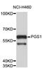 Phosphatidylglycerophosphate Synthase 1 antibody, abx003202, Abbexa, Western Blot image 