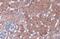 NAD(P)H Quinone Dehydrogenase 1 antibody, GTX100235, GeneTex, Immunohistochemistry paraffin image 