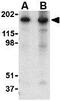 Reticulon 4 antibody, GTX85448, GeneTex, Western Blot image 