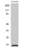 Myosin Light Chain 9 antibody, A06446-2, Boster Biological Technology, Western Blot image 