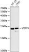 VPS29 Retromer Complex Component antibody, GTX65880, GeneTex, Western Blot image 