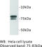 RETII antibody, MBS355107, MyBioSource, Western Blot image 
