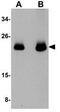 Cell Division Cycle 42 antibody, GTX85114, GeneTex, Western Blot image 