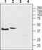 Tachykinin Receptor 2 antibody, PA5-77756, Invitrogen Antibodies, Western Blot image 