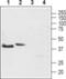 Tachykinin Receptor 2 antibody, PA5-77756, Invitrogen Antibodies, Western Blot image 