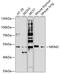 E3 ubiquitin-protein ligase Mdm2 antibody, 14-921, ProSci, Western Blot image 