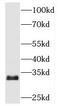 Tubulin Folding Cofactor B antibody, FNab08517, FineTest, Western Blot image 