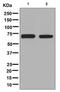 AKT Serine/Threonine Kinase 2 antibody, ab131168, Abcam, Western Blot image 