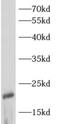 ADP Ribosylation Factor 3 antibody, FNab00531, FineTest, Western Blot image 
