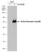 Activin A Receptor Type 2B antibody, GTX105330, GeneTex, Western Blot image 